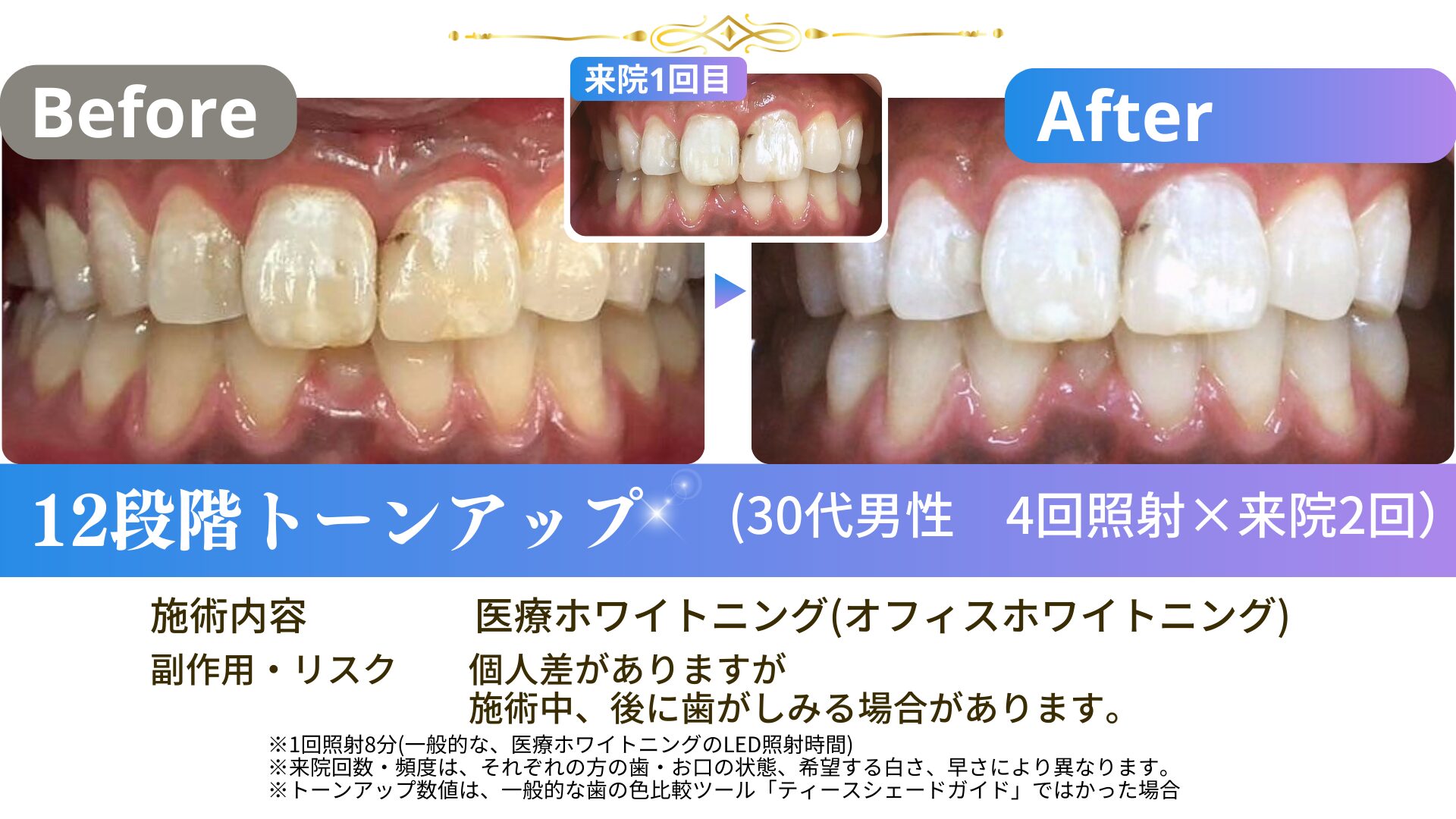 240928-30代男性スタンダード4回照射×2-30ms4×2-02