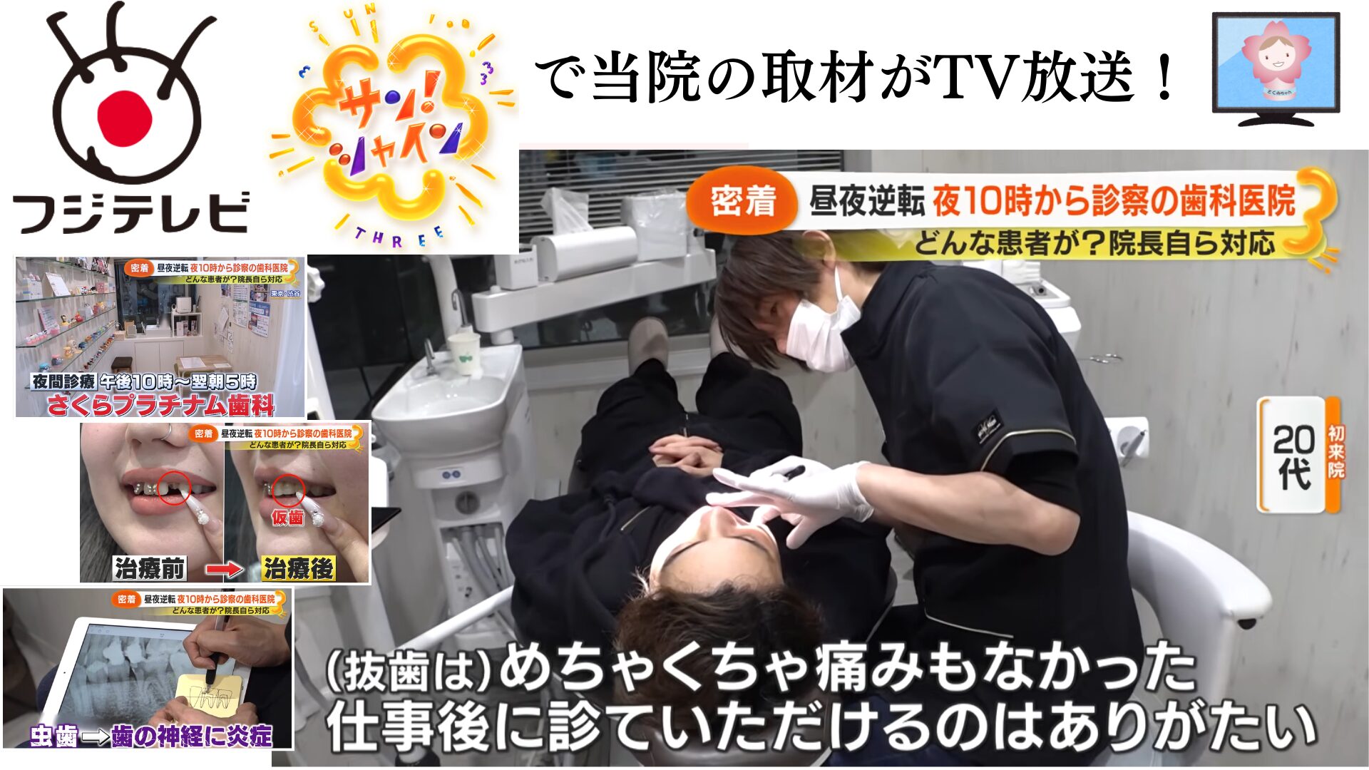 【テレビ放送】深夜診療を行う歯科医院としてフジテレビ『サン!シャイン』で取材放送