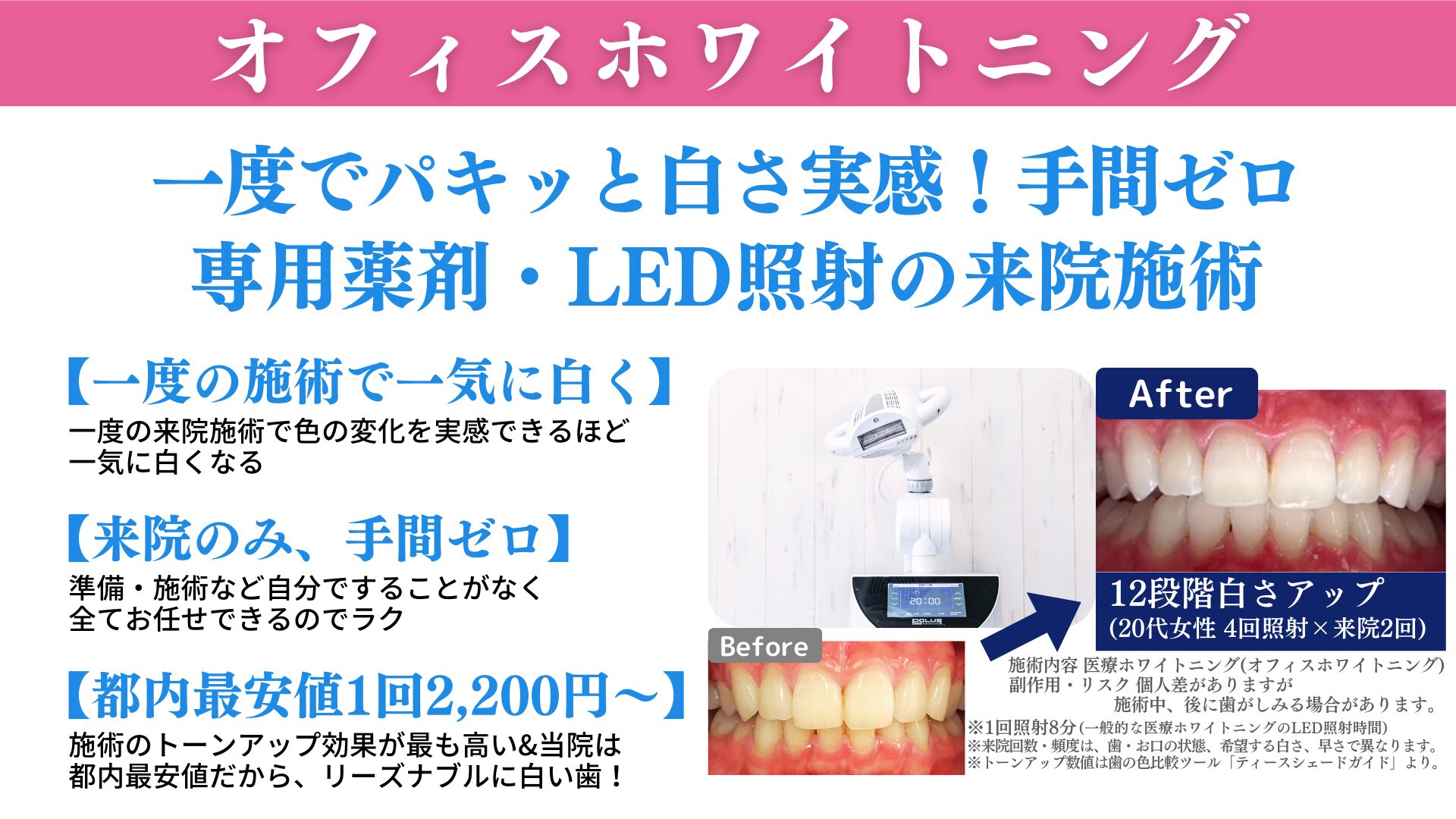 オフィスホワイトニングの効果はどれくらい持続する?白さを長持ちさせる秘訣